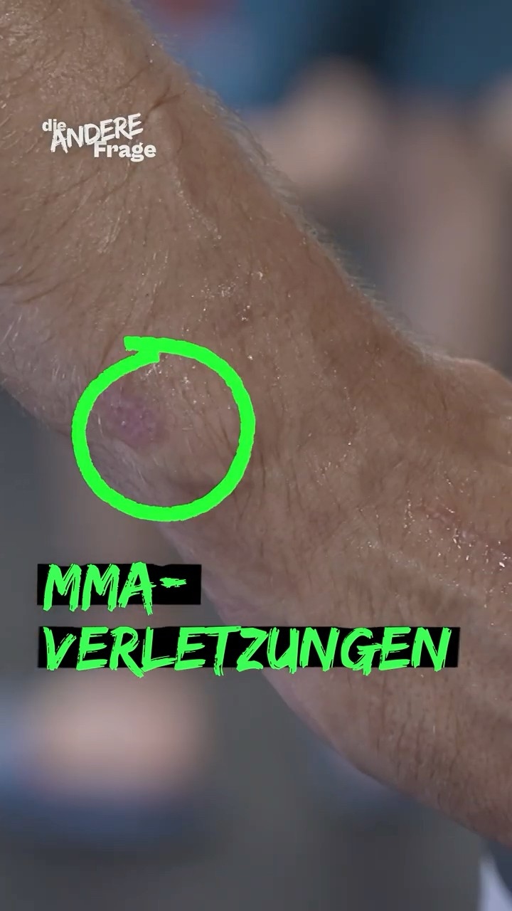 Nikos Verletzungen durch #MMA #funk #wdr