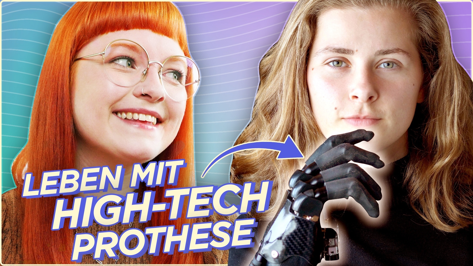 Diese Frau ist ein CYBORG – Greta hat eine High-Tech-Hand!