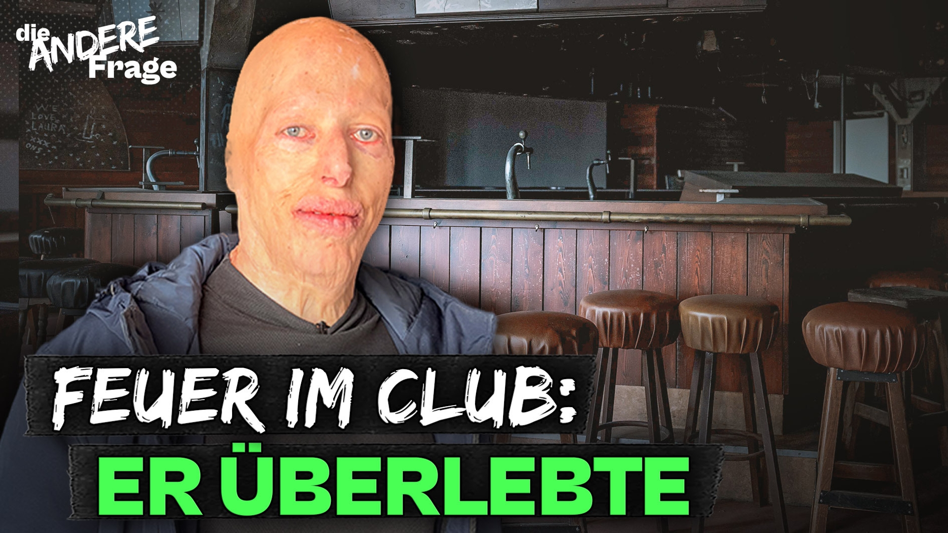 Brandkatastrophe im Club: Wie er verletzt überlebt